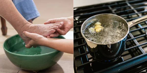 nail fungus treatment