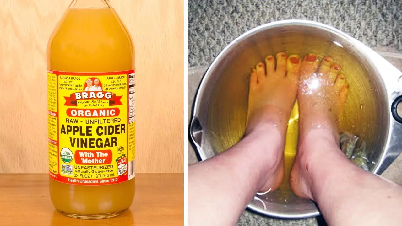 nail fungus treatment hack